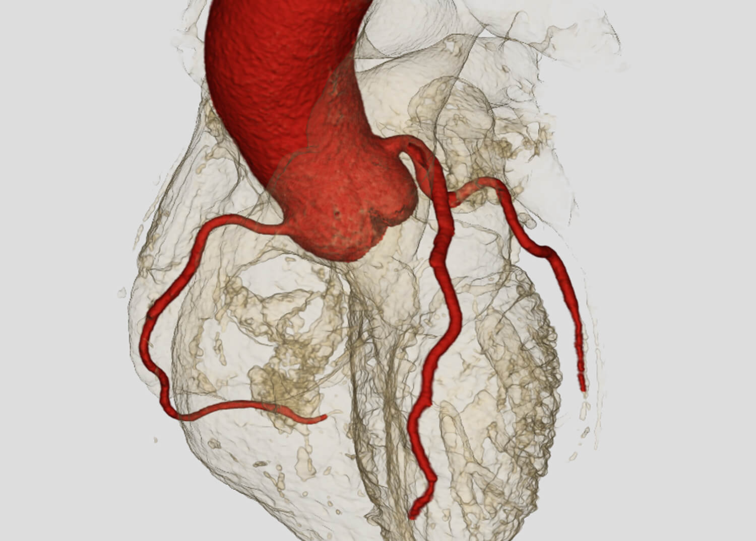 Cardiac Imaging