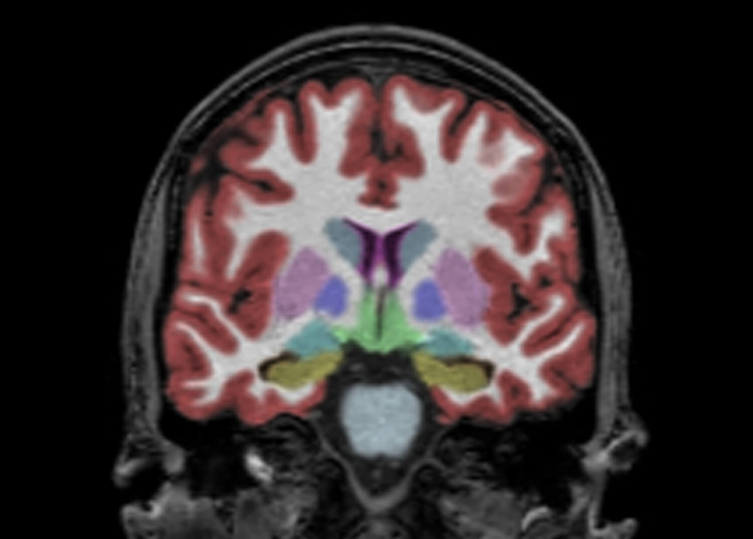 Neuro Imaging