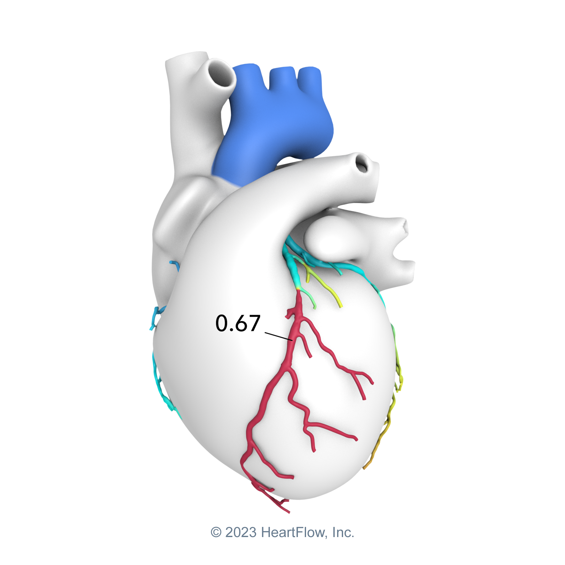 HeartFlow-StylizedHeart-NoBkgr-Web-1